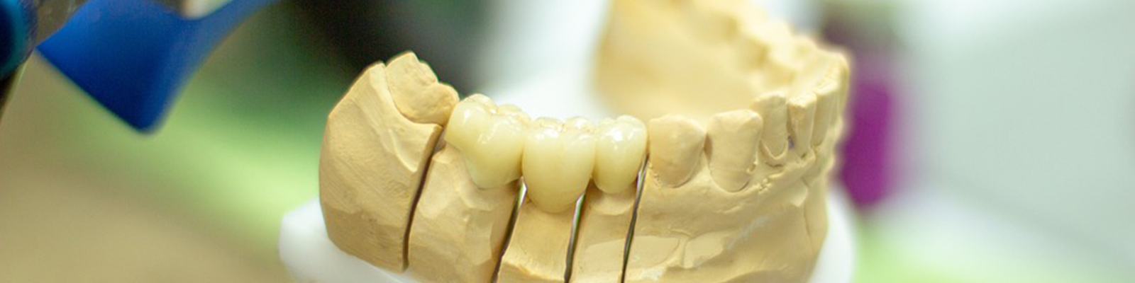 Maestría en Rehabilitación Bucal e Implantes Dentales
